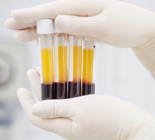 Osocze będzie pobierane w jeleniogórskim szpitalu