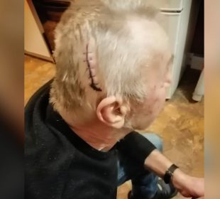 Co wydarzyło się podczas interwencji pogotowia?