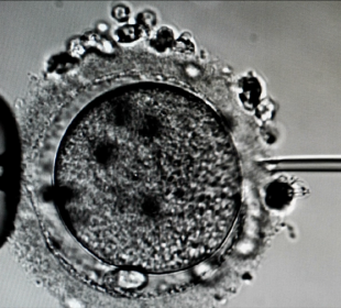 In Vitro w Jeleniej Górze
