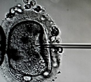In Vitro w Jeleniej Górze In Vitro w Jeleniej Górze