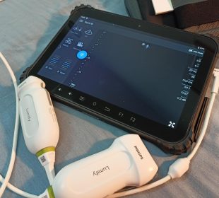 Światowej klasy sprzęt kardiologiczny ratujący życie już w rękach jeleniogórskich medyków Światowej klasy sprzęt kardiologiczny ratujący życie już w rękach jeleniogórskich medyków